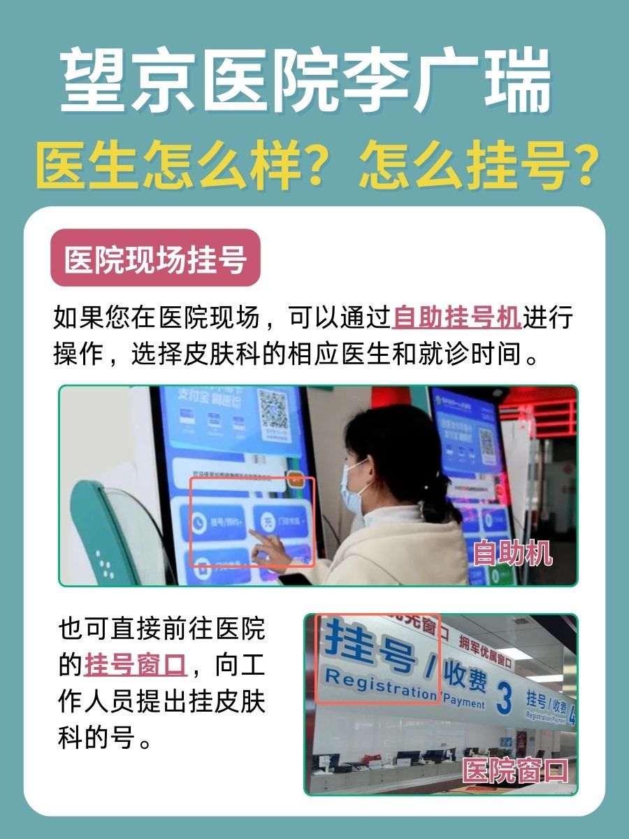 北京望京医院李广瑞医生怎么样？怎么挂号？