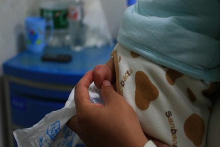 脊髓栓系综合征长小尾巴图 脊髓栓系综合征长小尾巴图