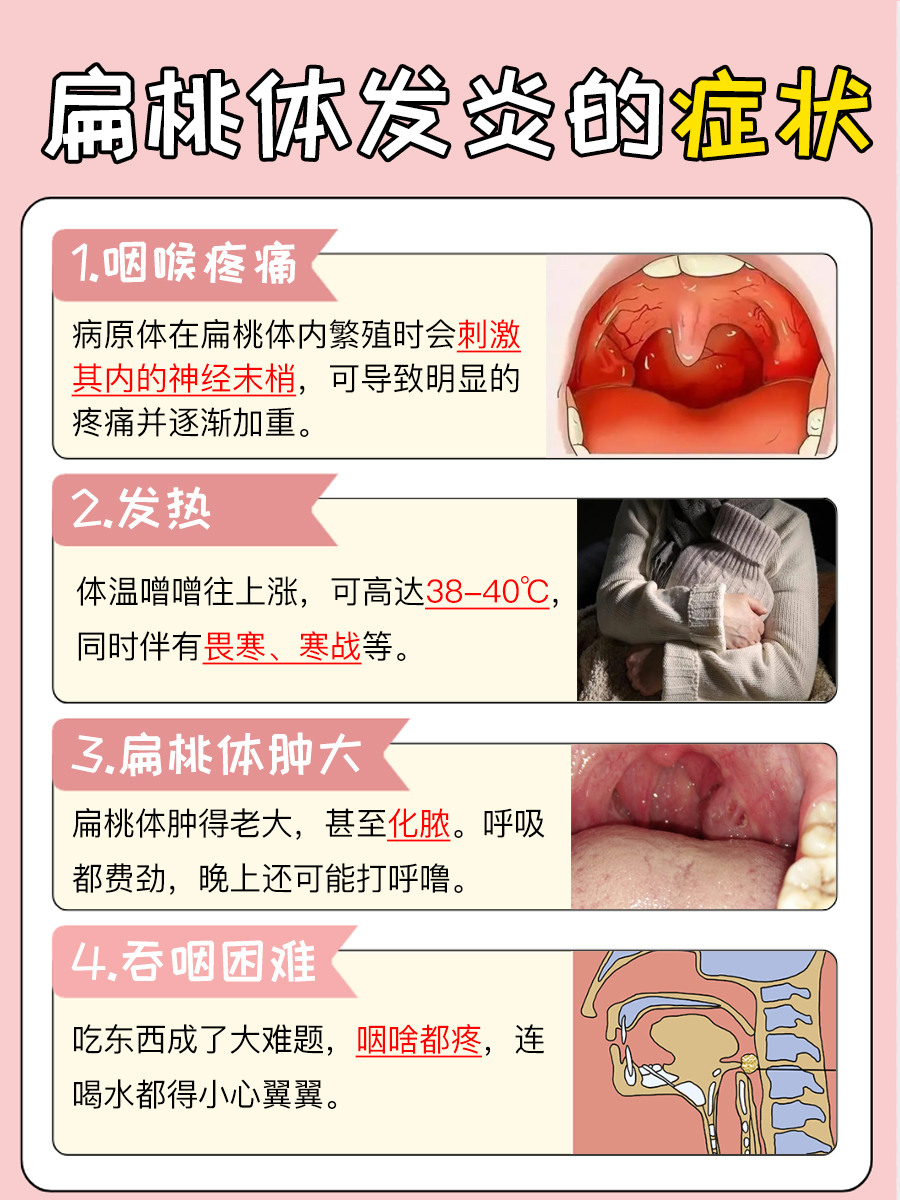 扁桃体发炎来袭，看看这些症状你中招了吗？