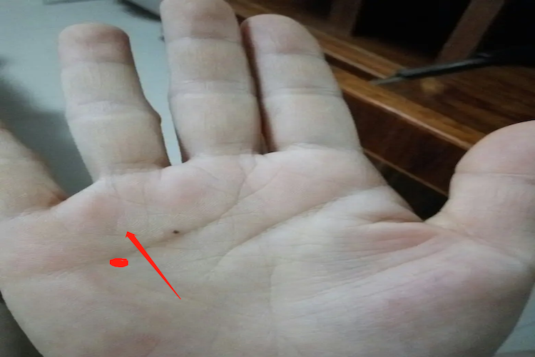 肝反射区手掌部位图