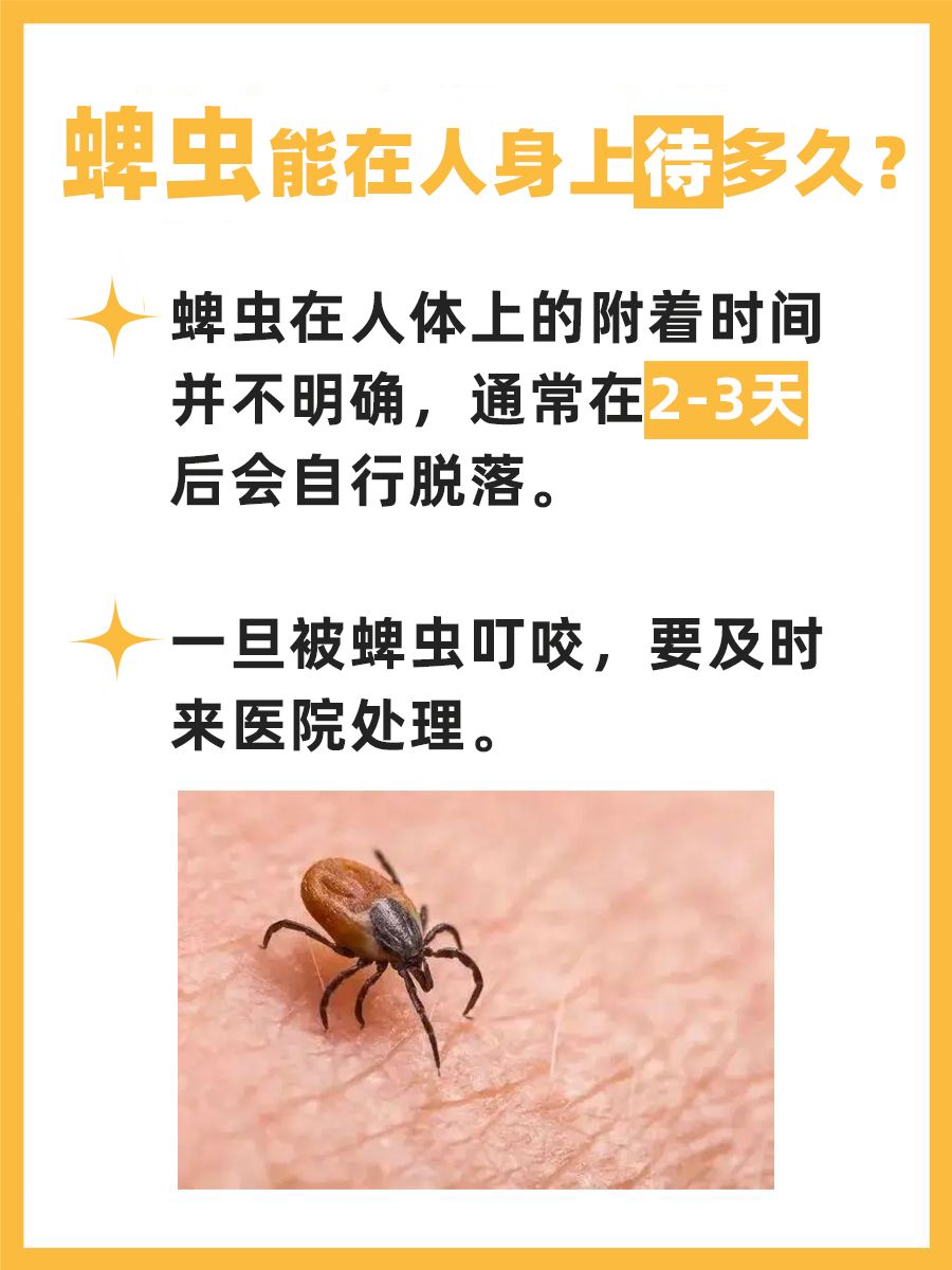 蜱虫“入住”人体，它能待多久不走？