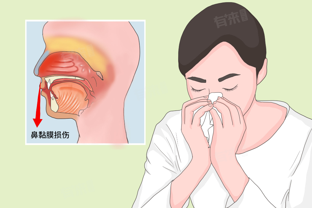 怎么判断是不是鼻后滴漏