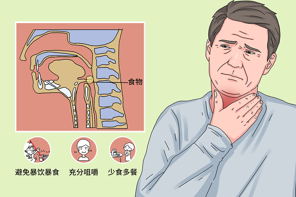 吞咽障碍漫画图片
