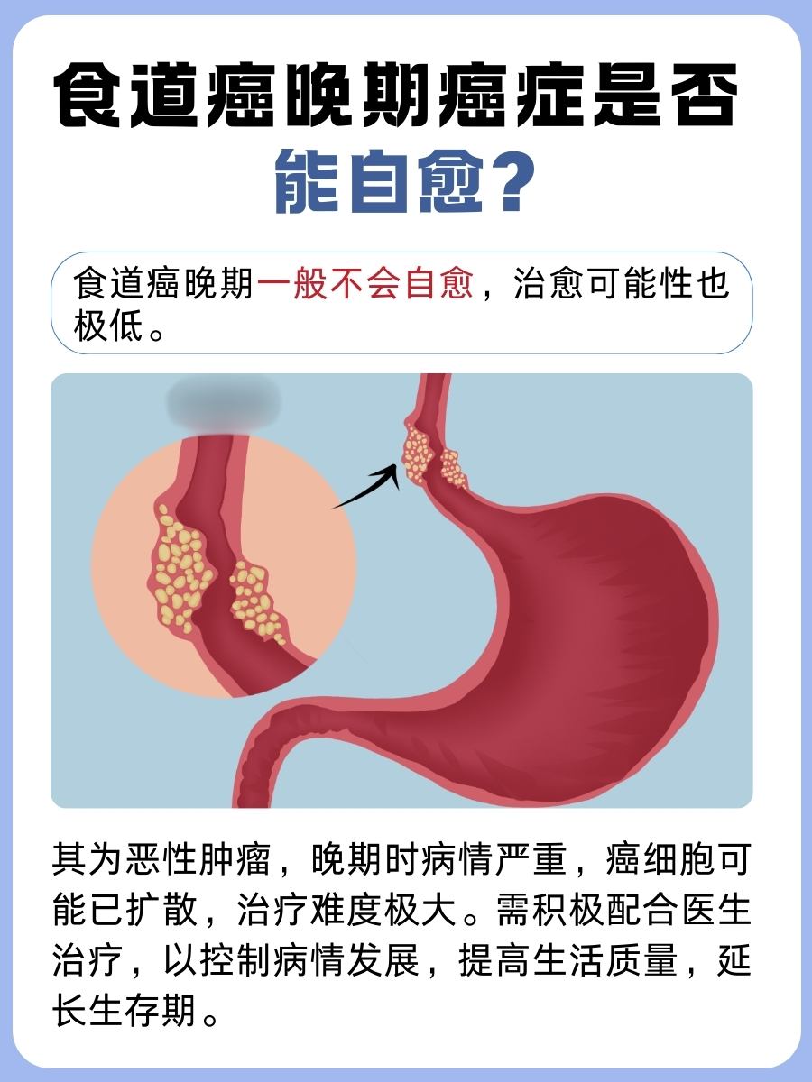食道癌晚期癌症能自愈吗？医生告诉你答案