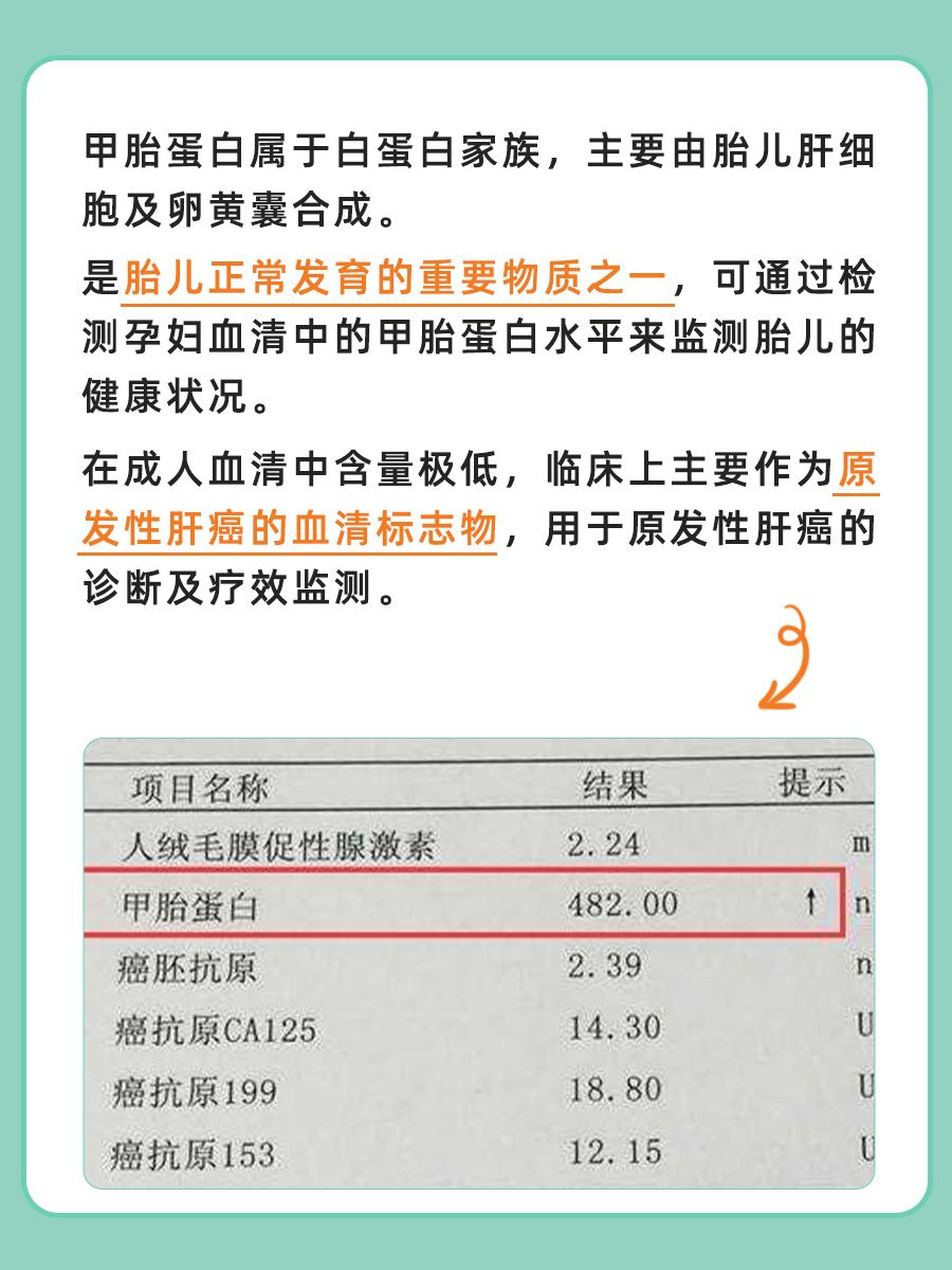 一文带你读懂什么是甲胎蛋白