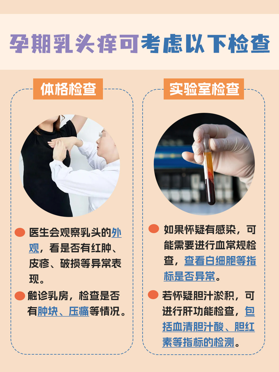 孕期乳头痒的原因：医生解答