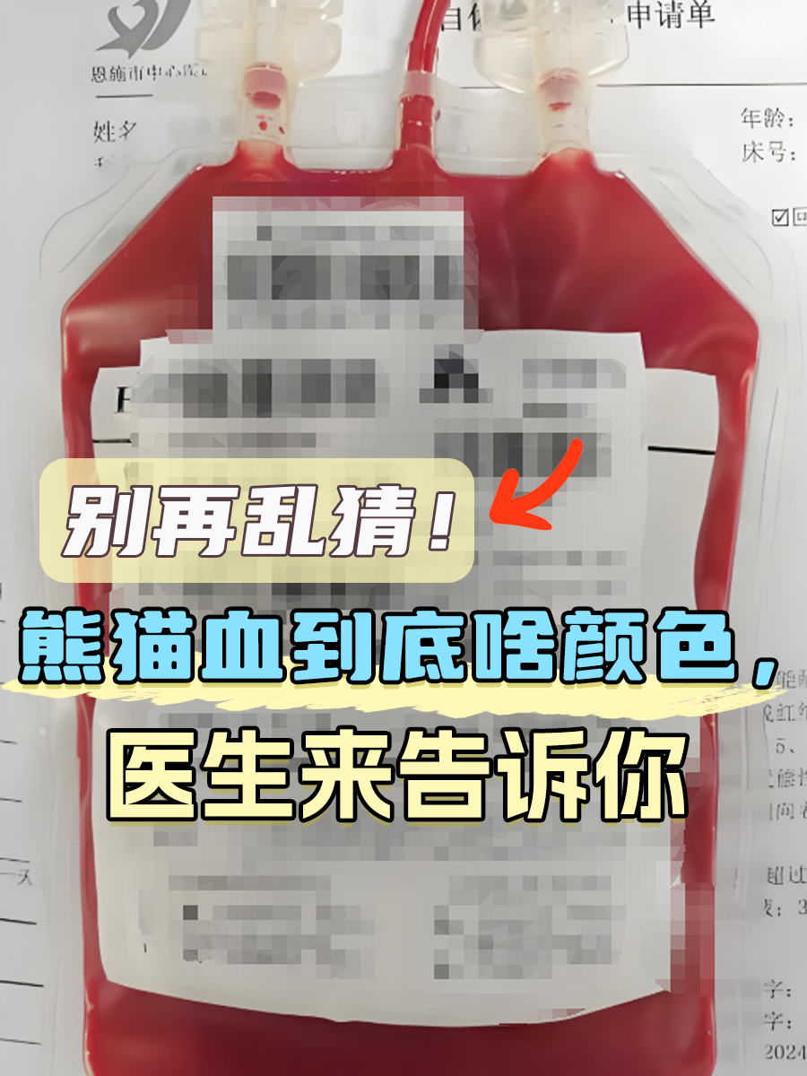 别再乱猜！熊猫血到底啥颜色，医生来告诉你