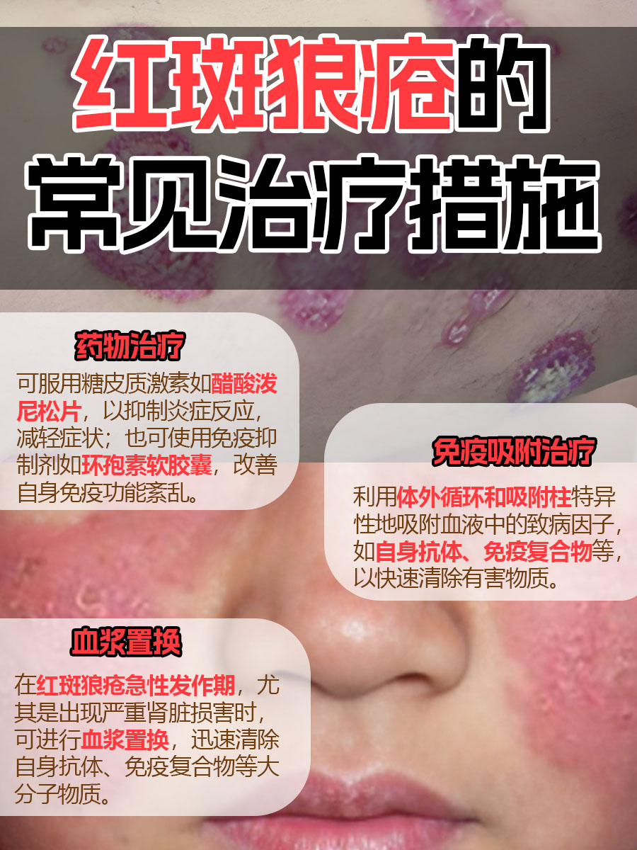 红斑狼疮患者慎饮！三水黑名单！