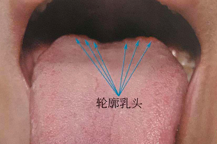 轮廓乳头:舌体表面有许多红色小凸起的舌乳头,其中轮廓乳头体积最大