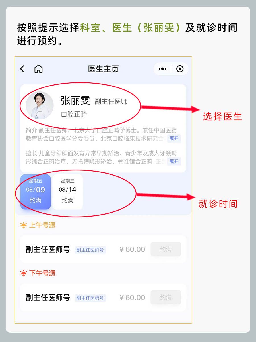 中日友好医院张丽雯医生怎么样？怎么挂号？
