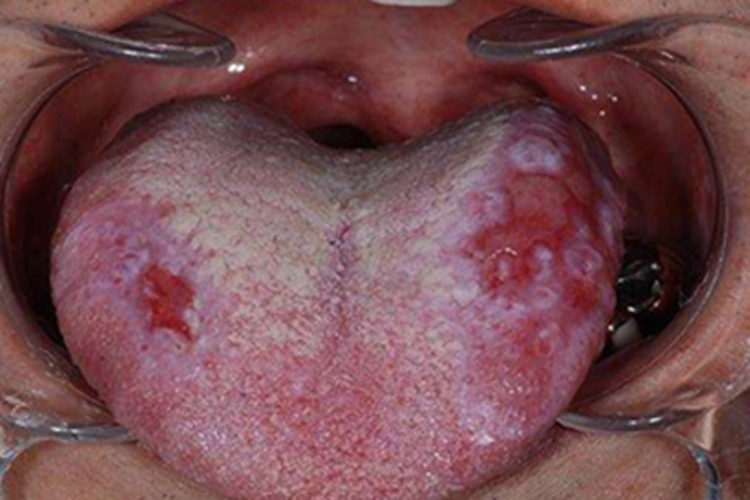 本文由有来医生原创,经专业医师审核校对