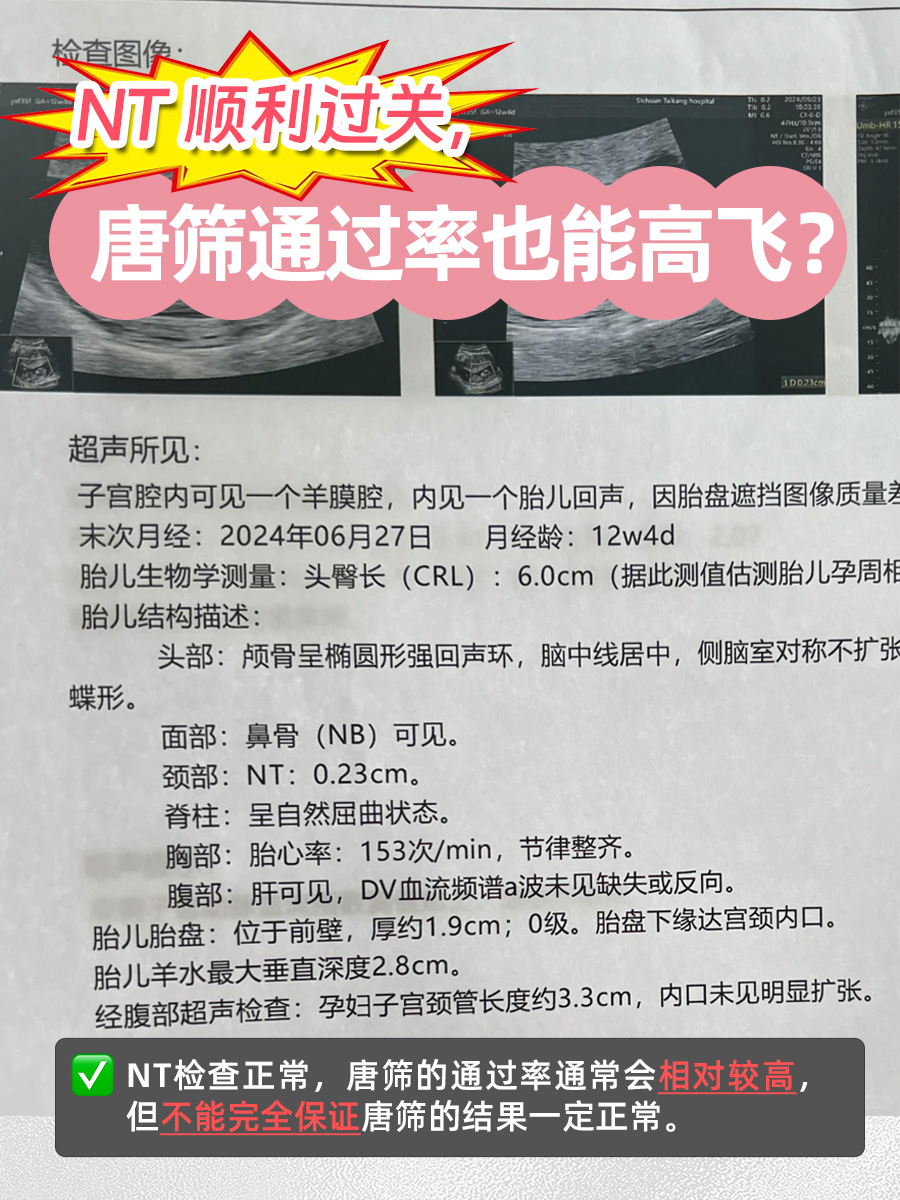 NT顺利过关，唐筛通过率也能高飞？