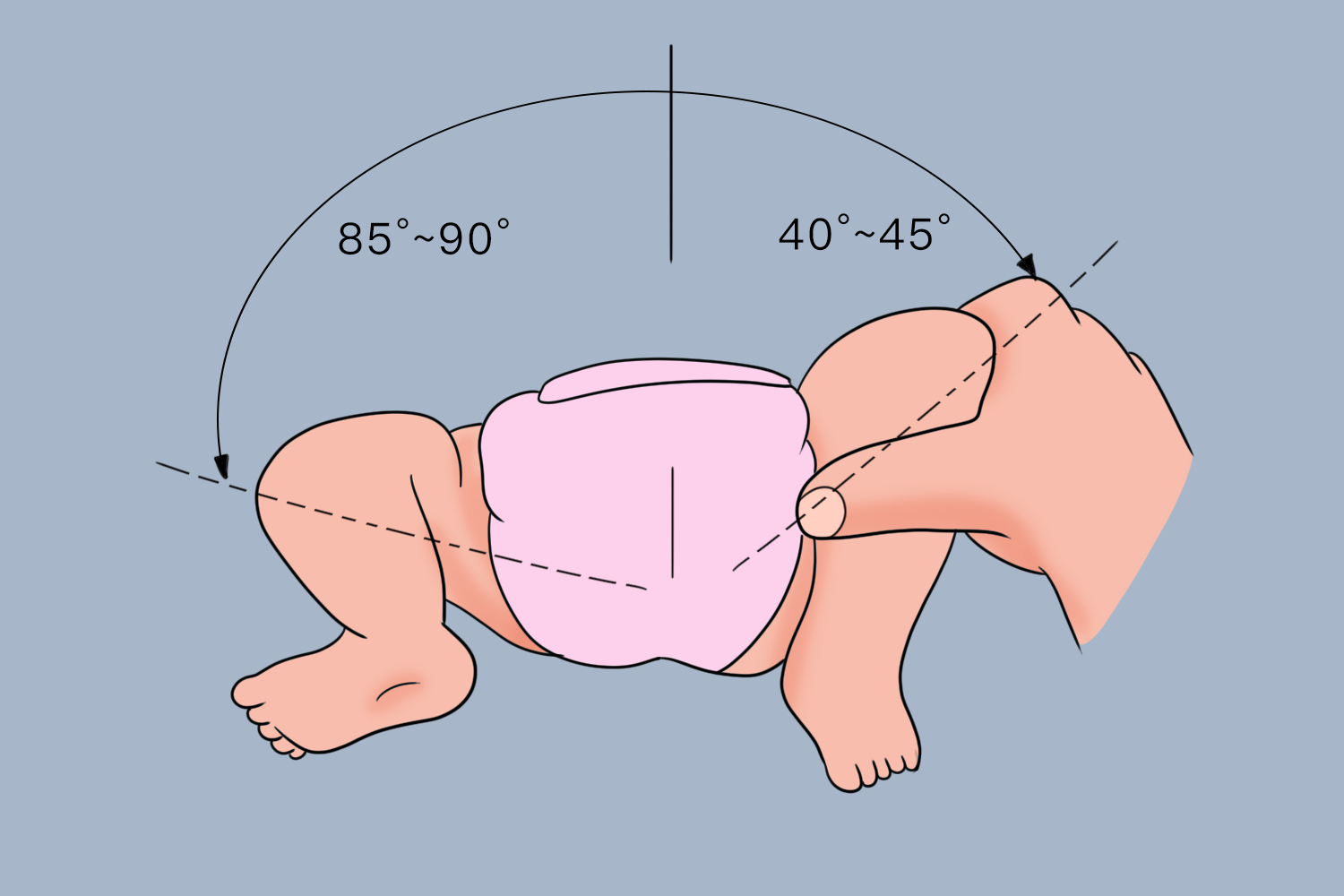 髋关节脱位活动异常图