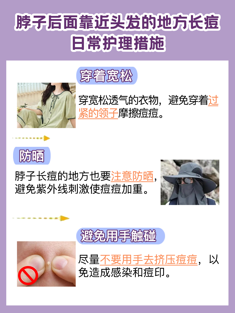 医生解答：脖子后面靠近头发的地方为什么长痘?