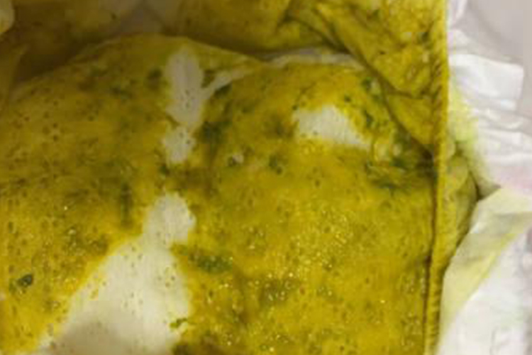 受凉后稀糊状大便图