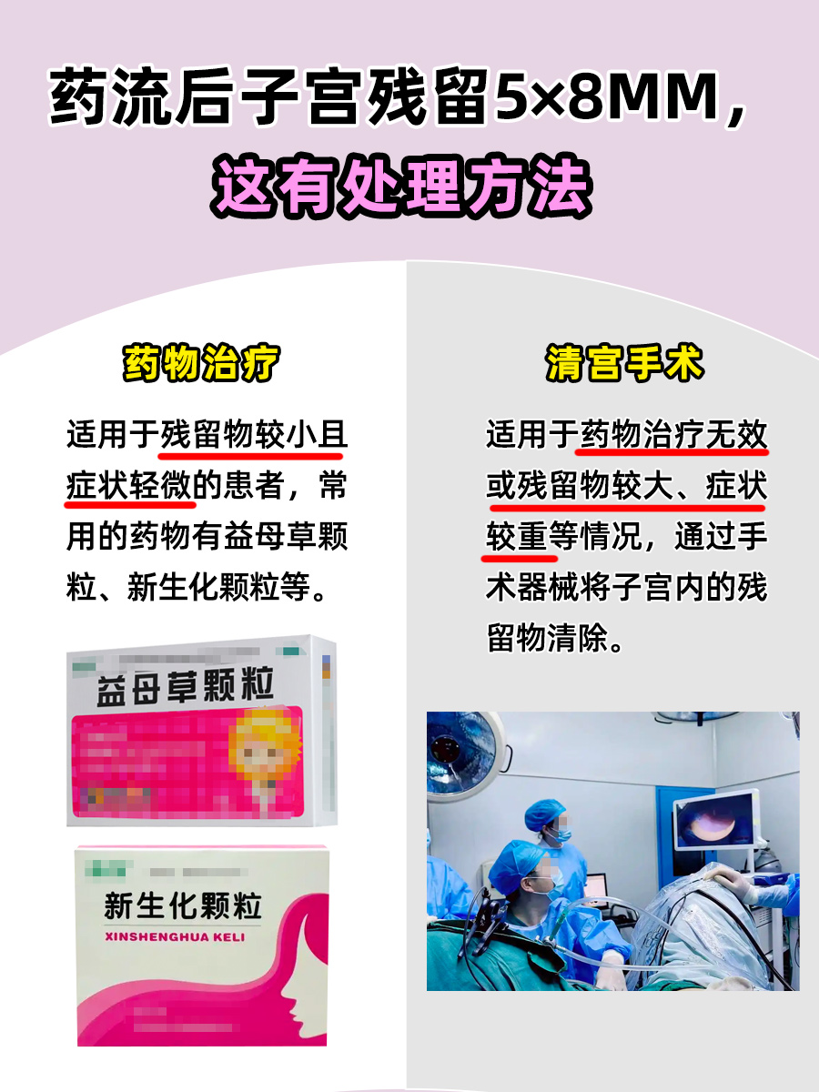 药流后残留别忽视!5×8㎜残留清除有方!