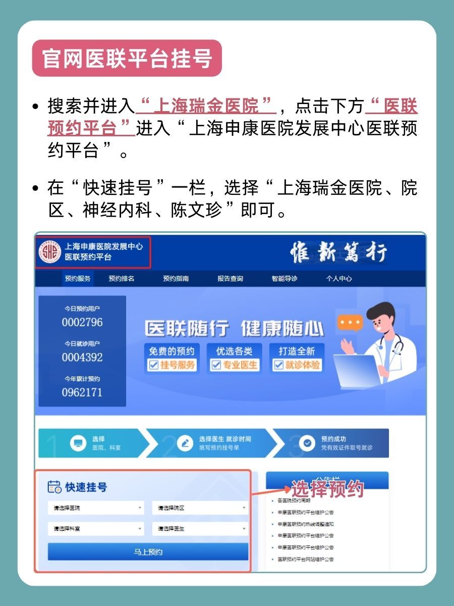 上海瑞金医院陈文珍医生怎么样？怎么挂号？