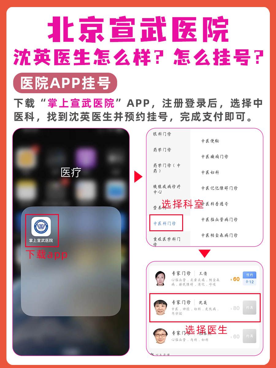 北京宣武医院沈英医生怎么样?怎么挂号?