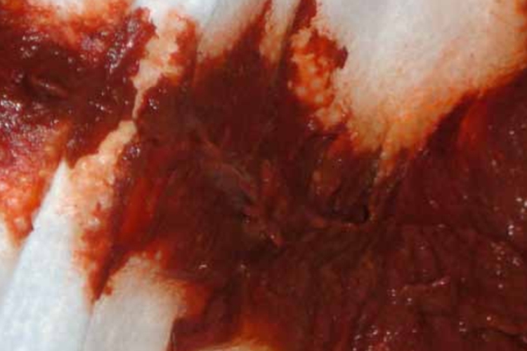 红色便图 红色便图