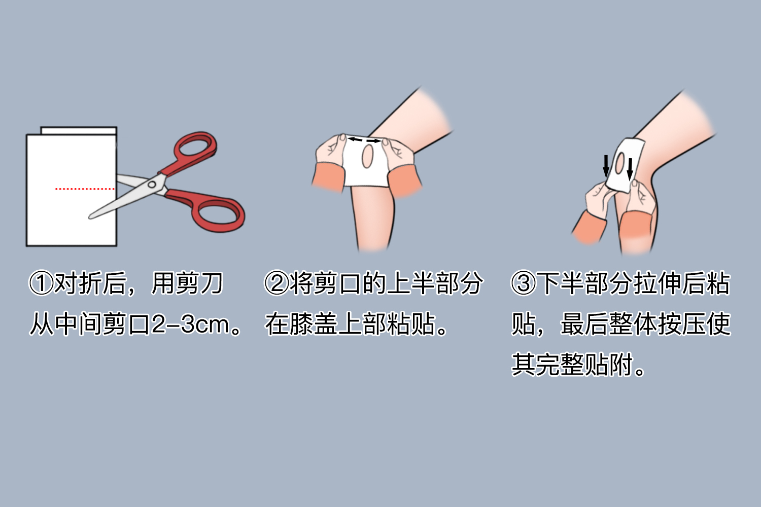 氟比洛芬凝胶贴膏贴附膝关节图