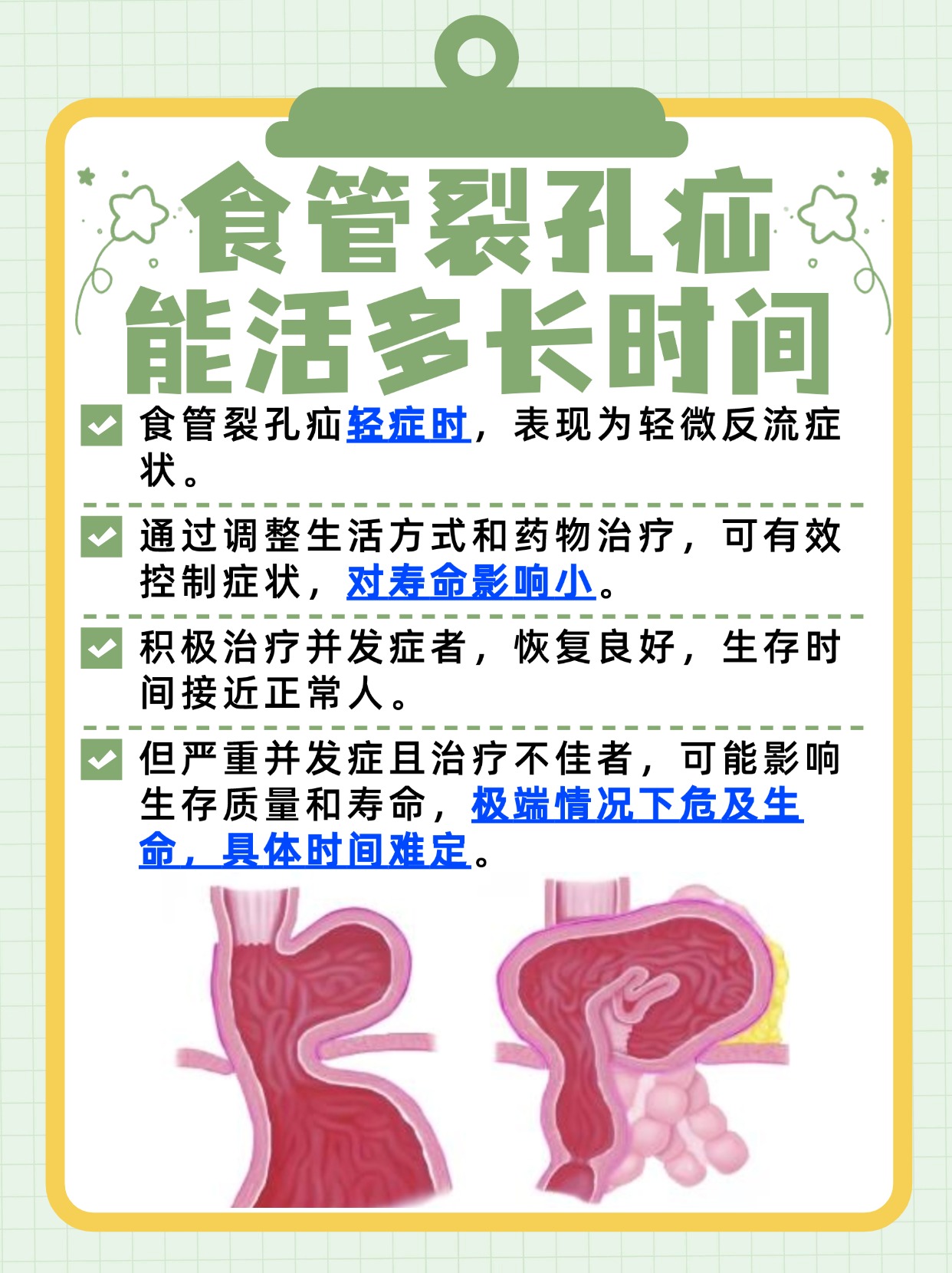 探究：食管裂孔疝能活多长时间