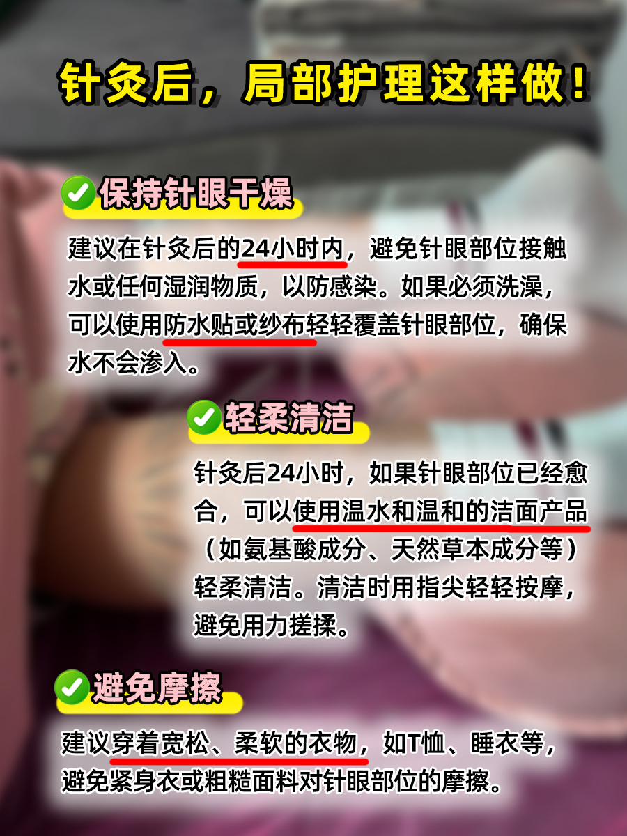 速看！针灸后吹风行不行？