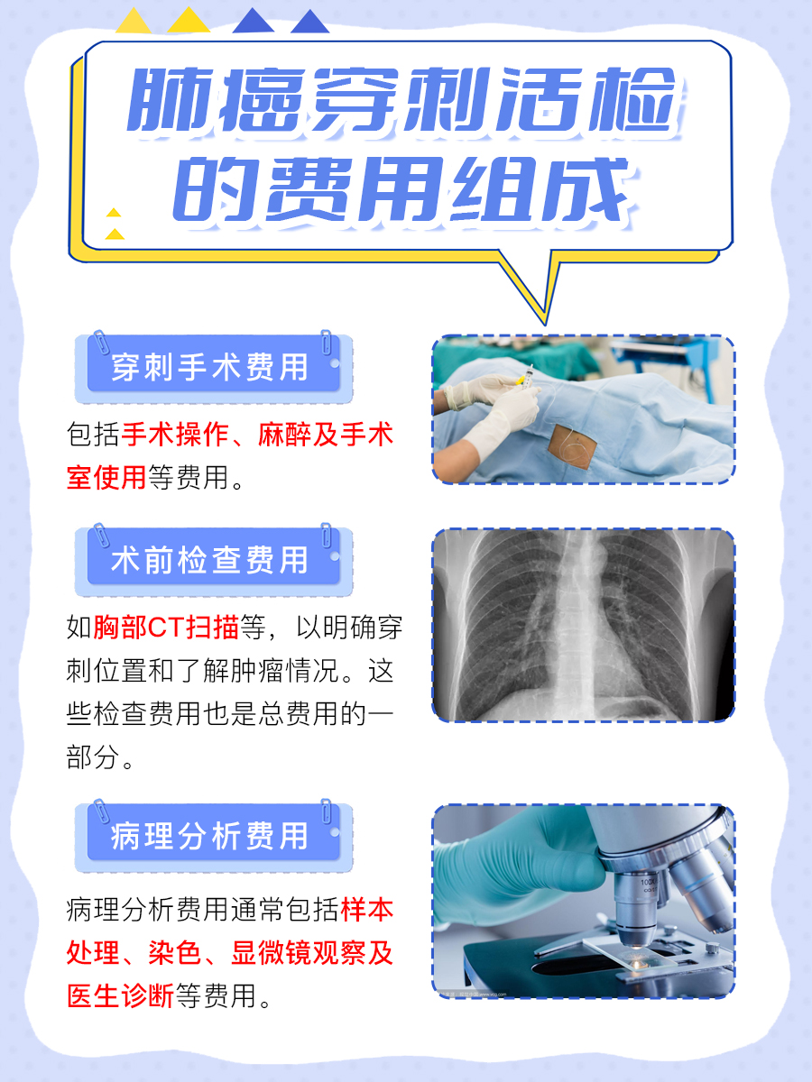 肺癌穿刺活检费用揭晓：至少上千！