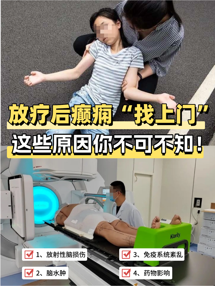 放疗后癫痫“找上门”，这些原因你不可不知！