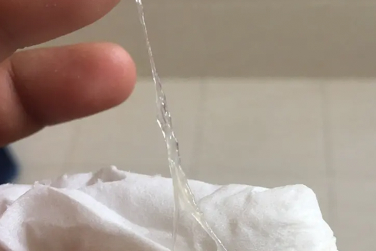 排卵期宫颈粘液图