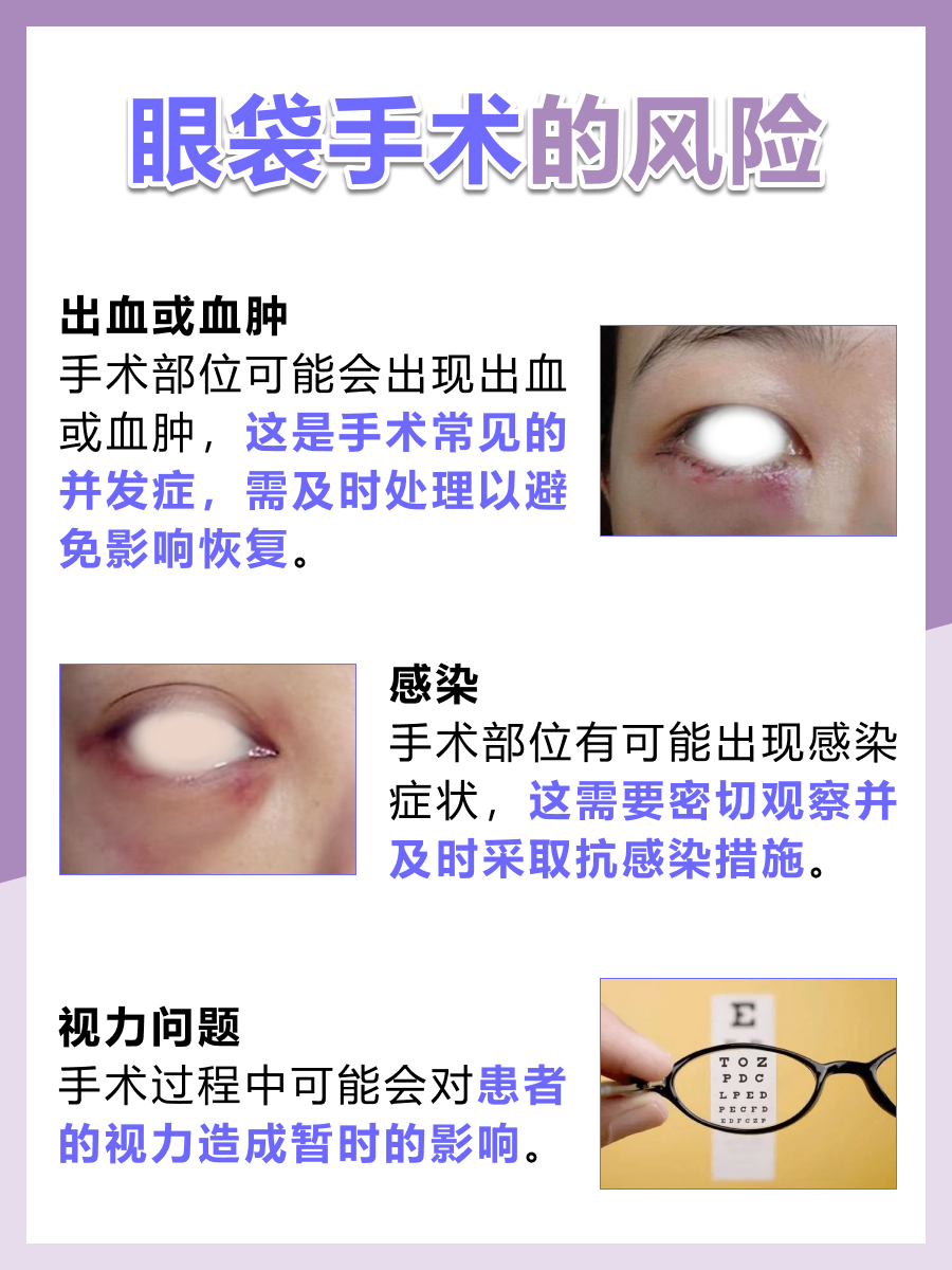 眼袋手术全方位解析：告别眼袋困扰