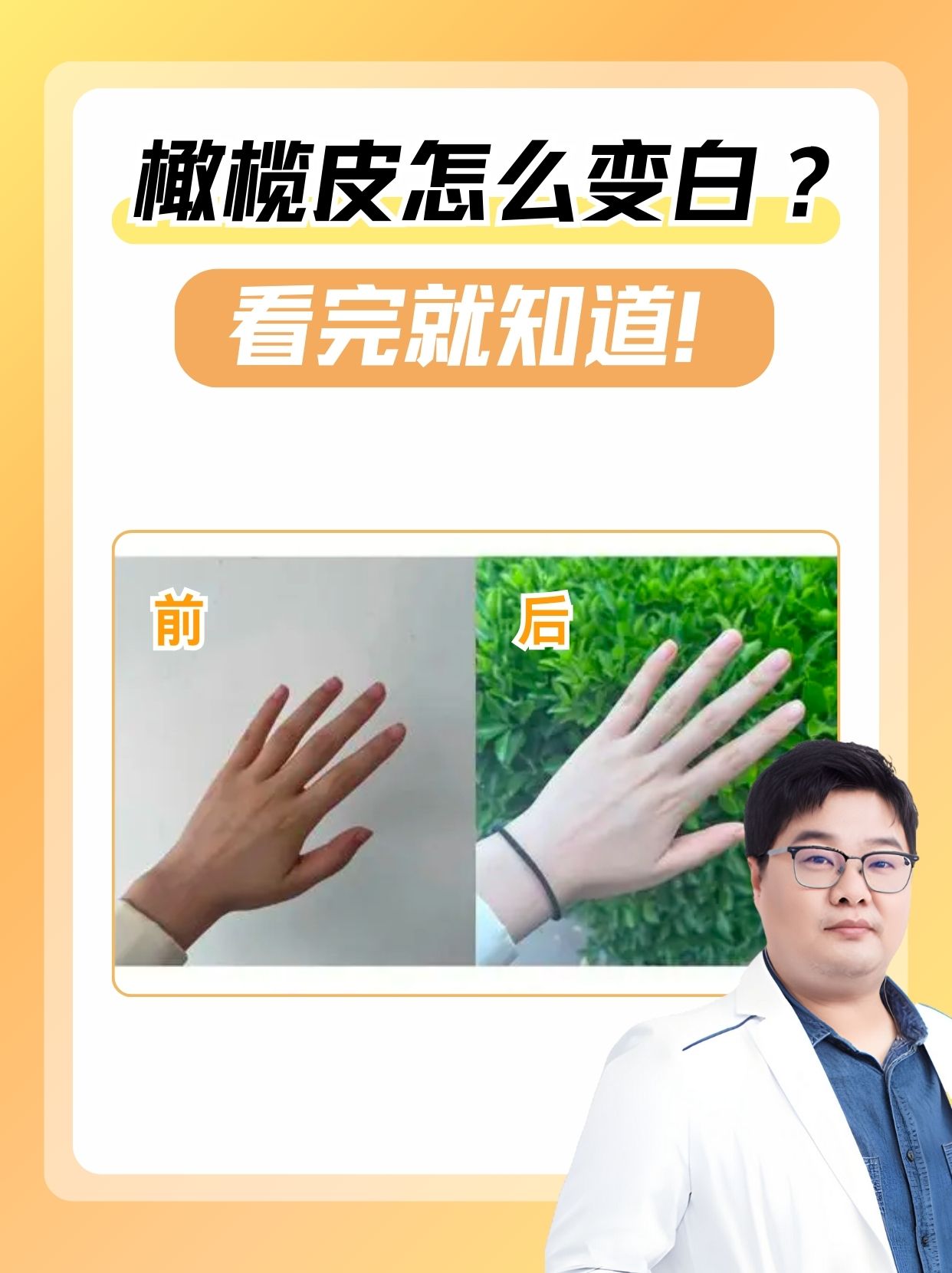 橄榄皮怎么变白？看完就知道！