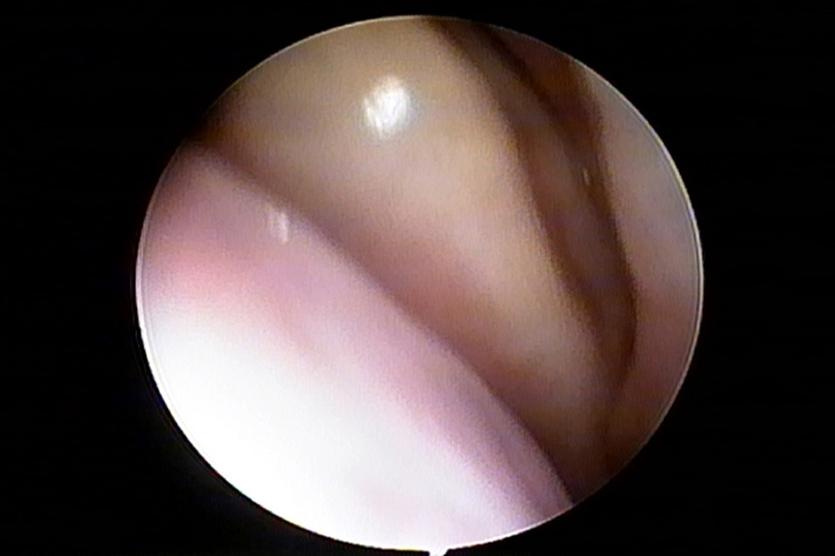 正常鼻甲图 正常鼻甲图