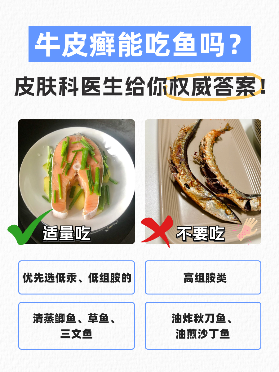牛皮癣能吃鱼吗？皮肤科医生给你权威答案！