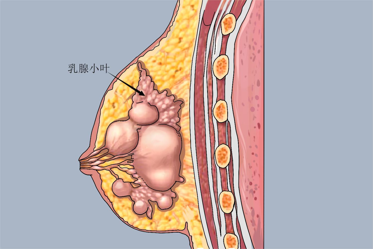 乳腺小叶异常位置图 乳腺小叶异常位置图