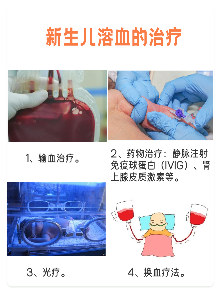 母亲Rh阴性、胎儿Rh阳性，小心新生儿溶血！