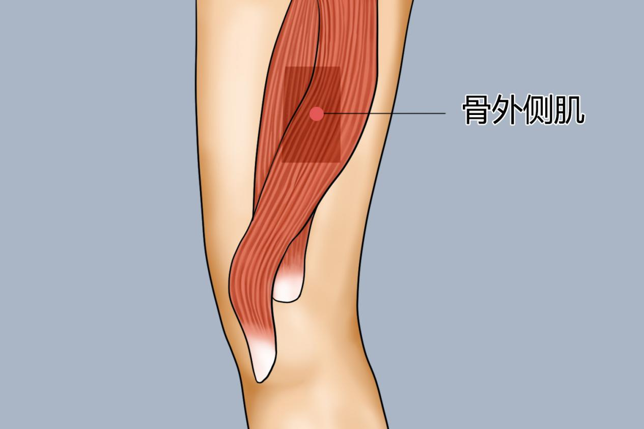 儿童股外侧肌注射位置图