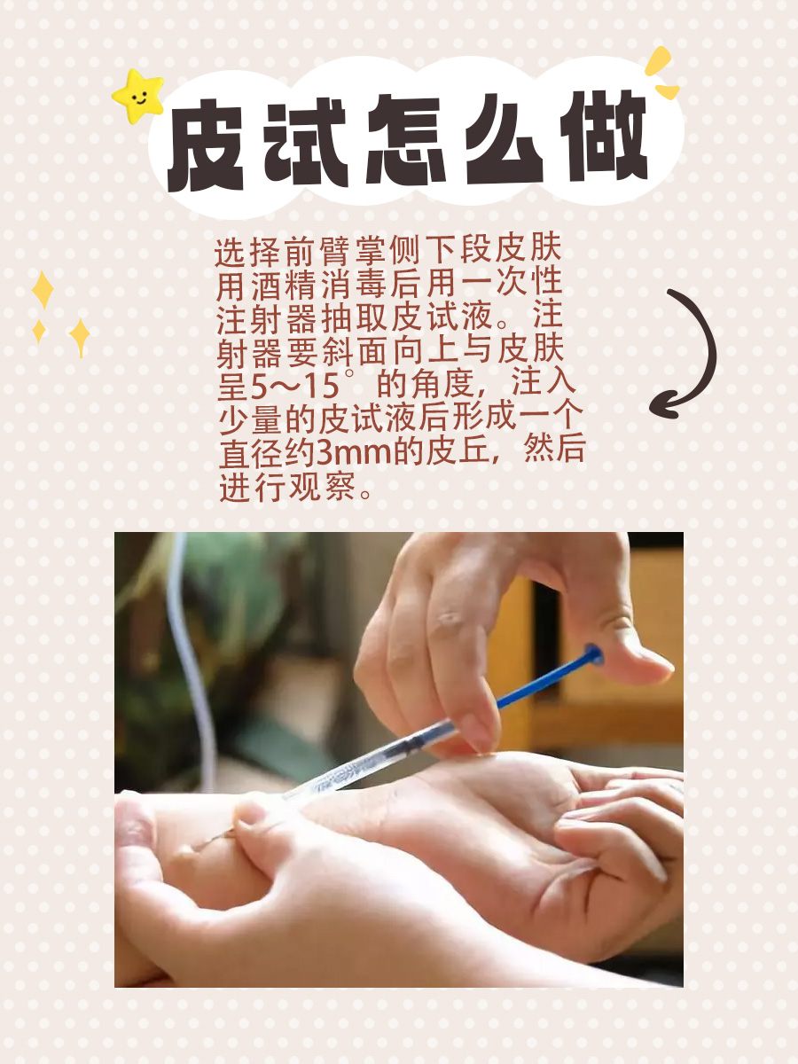 皮试这样做！安全用药的第一步