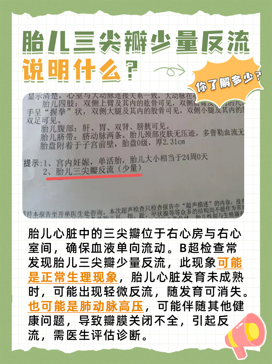 一文解析：胎儿三尖瓣少量反流说明什么?