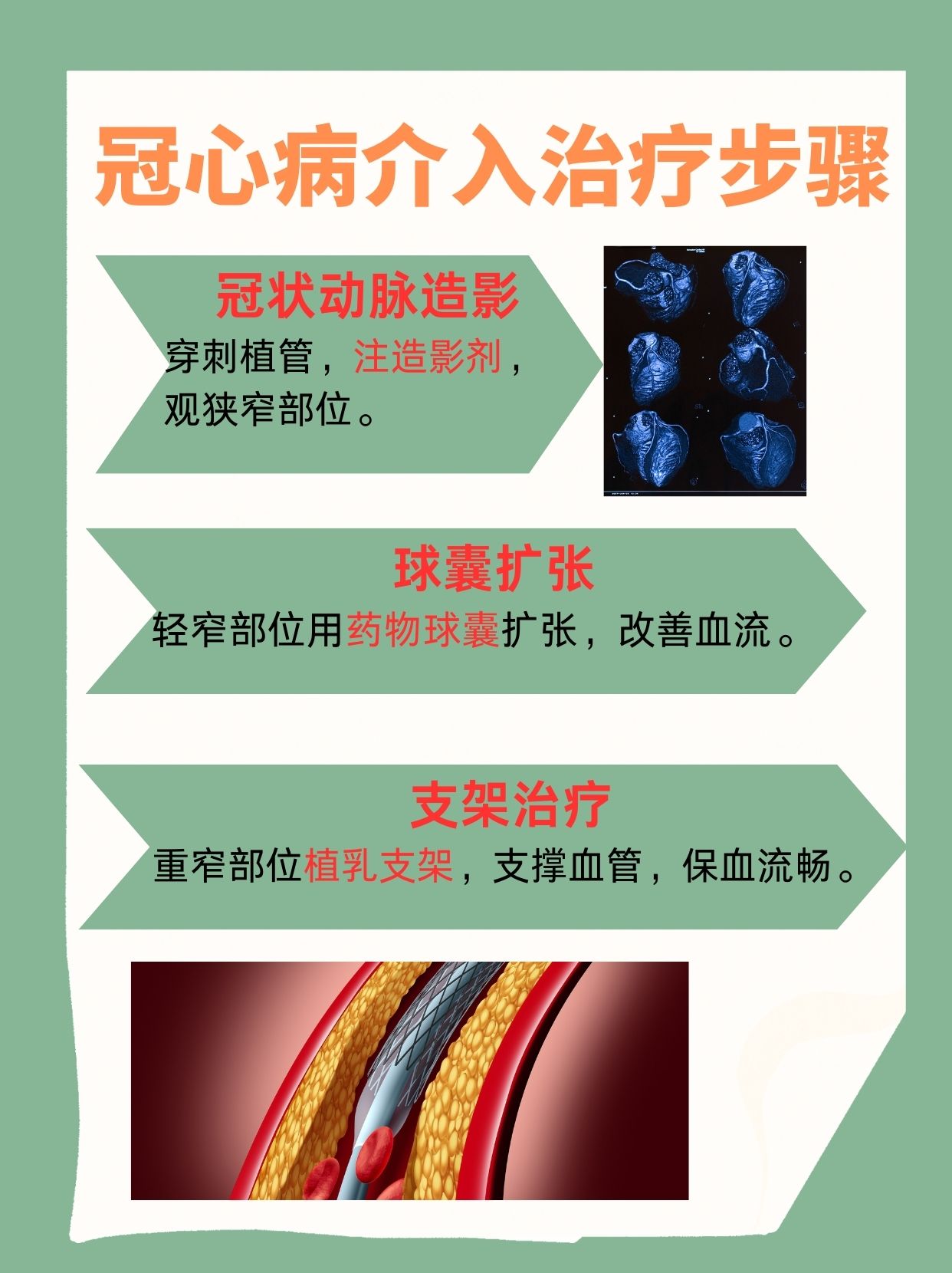 冠心病介入治疗和放支架一样吗?一文告诉你