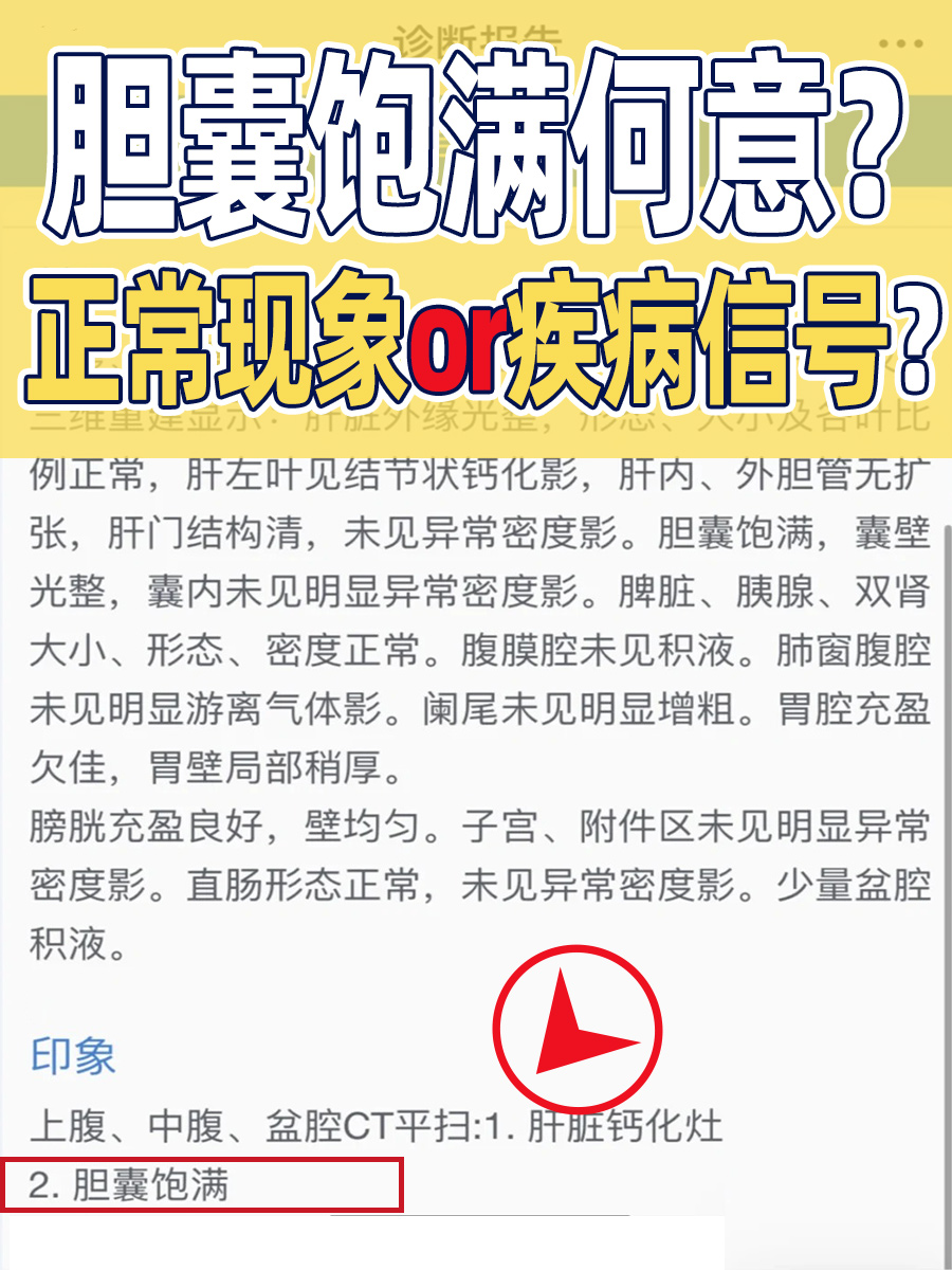 胆囊饱满何意？正常现象or疾病信号？
