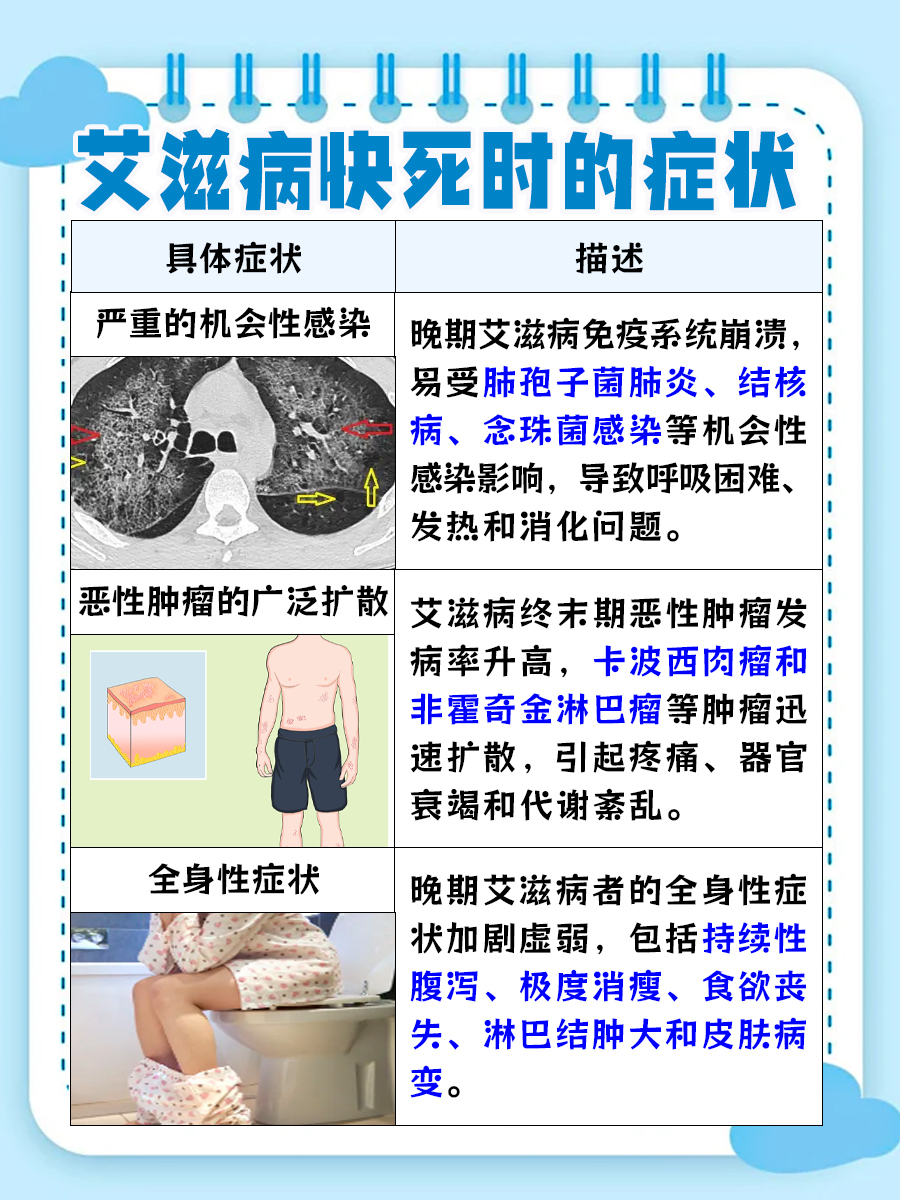 艾滋病快死时,有哪些症状?