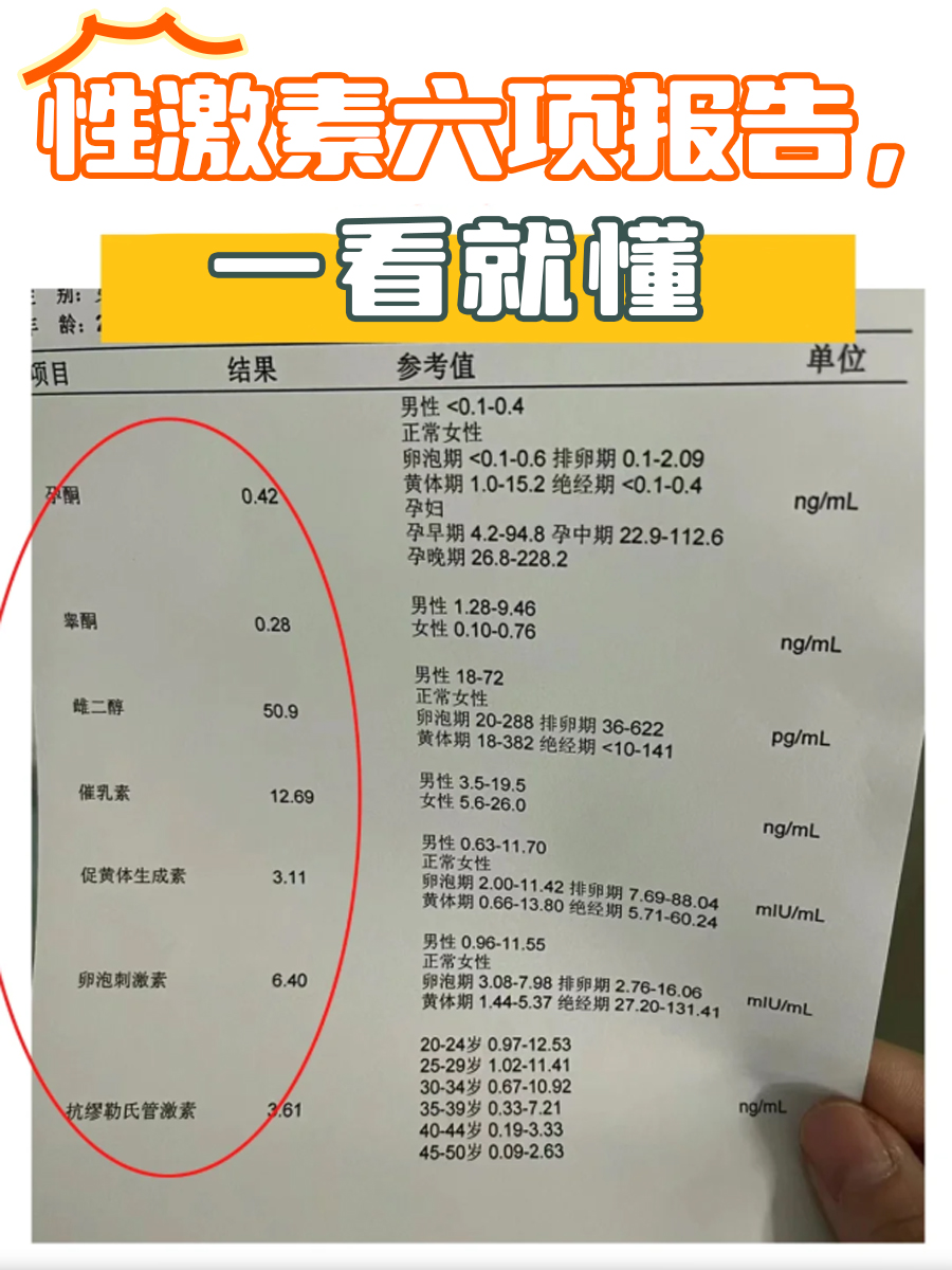 性激素六项报告，一看就懂
