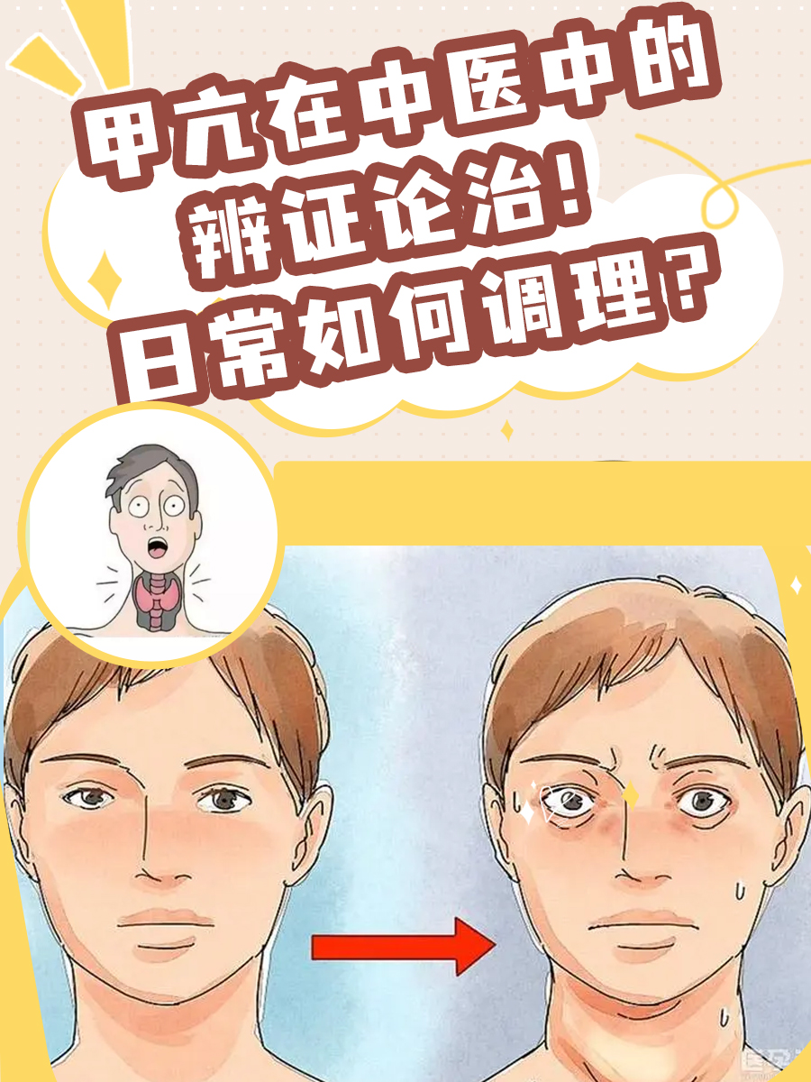 甲亢在中医中的辨证论治！日常如何调理？