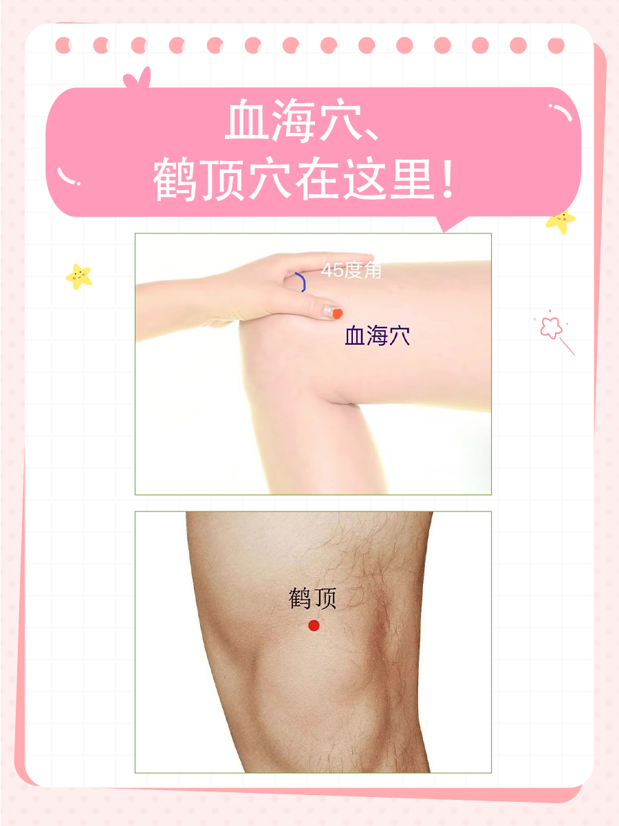 为什么医生不建议用德国马膏？原因找到了