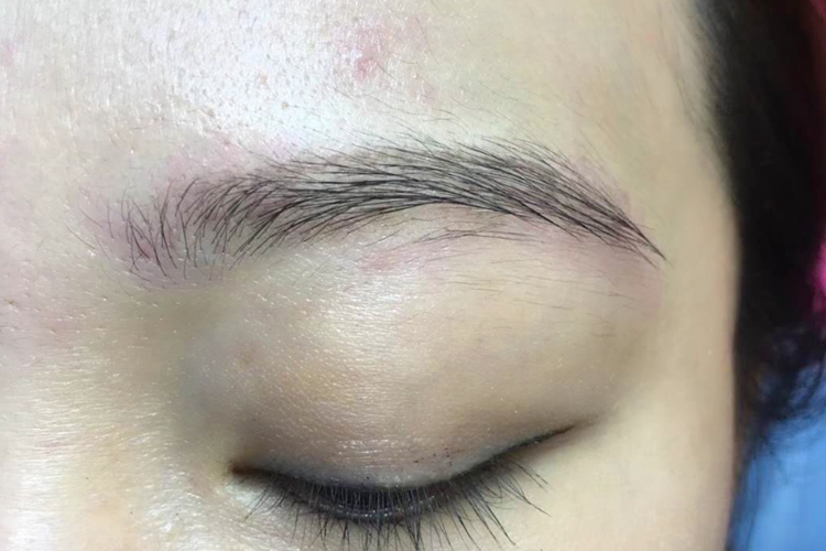 走空针洗眉效果图