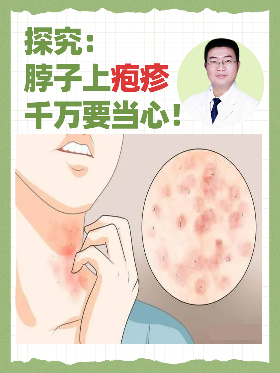 探究：脖子上疱疹千万要当心！