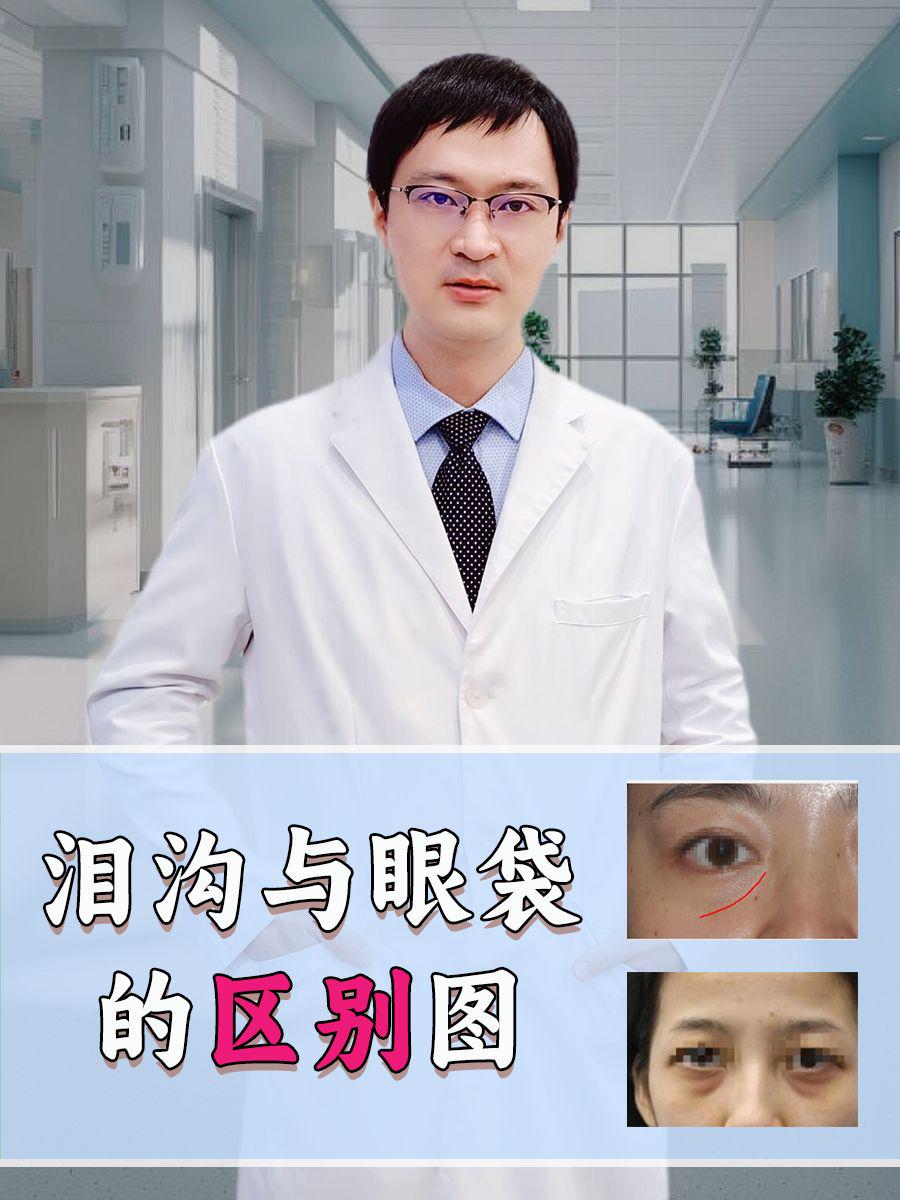 泪沟与眼袋的区别图