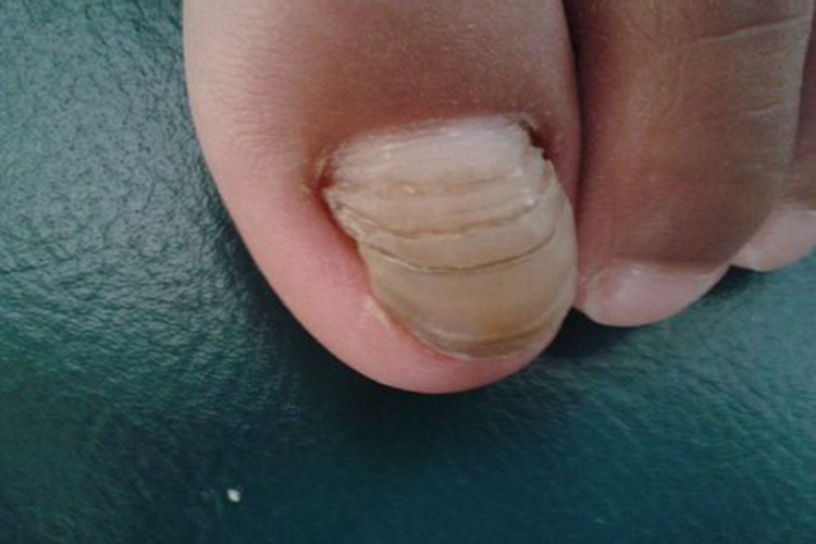 甲横沟图 甲横沟图