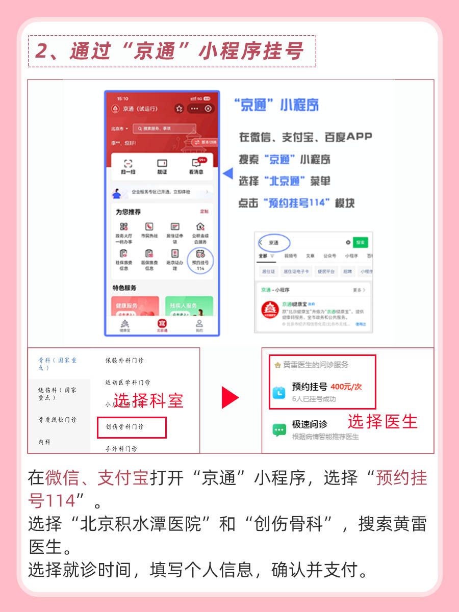 北京积水潭医院黄雷医生怎么样?怎么挂号?