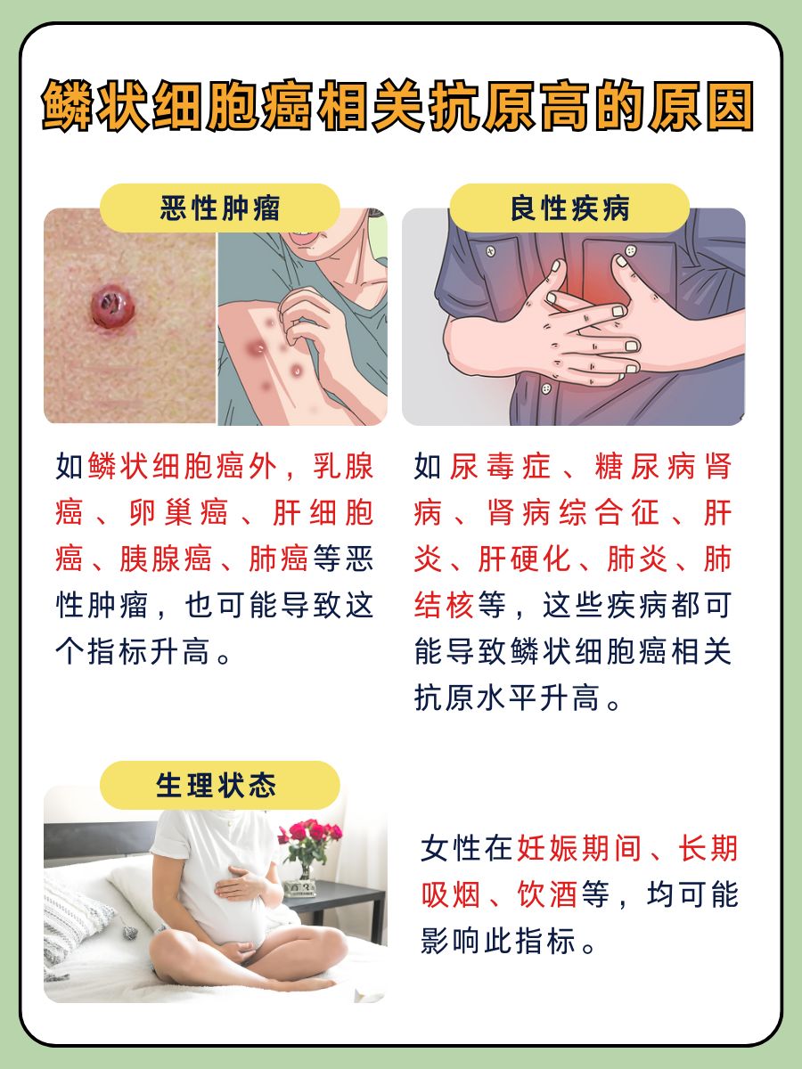 鳞状细胞癌相关抗原高，身体在告诉你什么秘密？